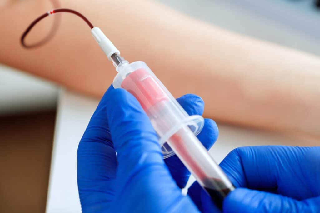 Quais planos de saúde atendem no Laboratório Pasteur Patologia Clínica