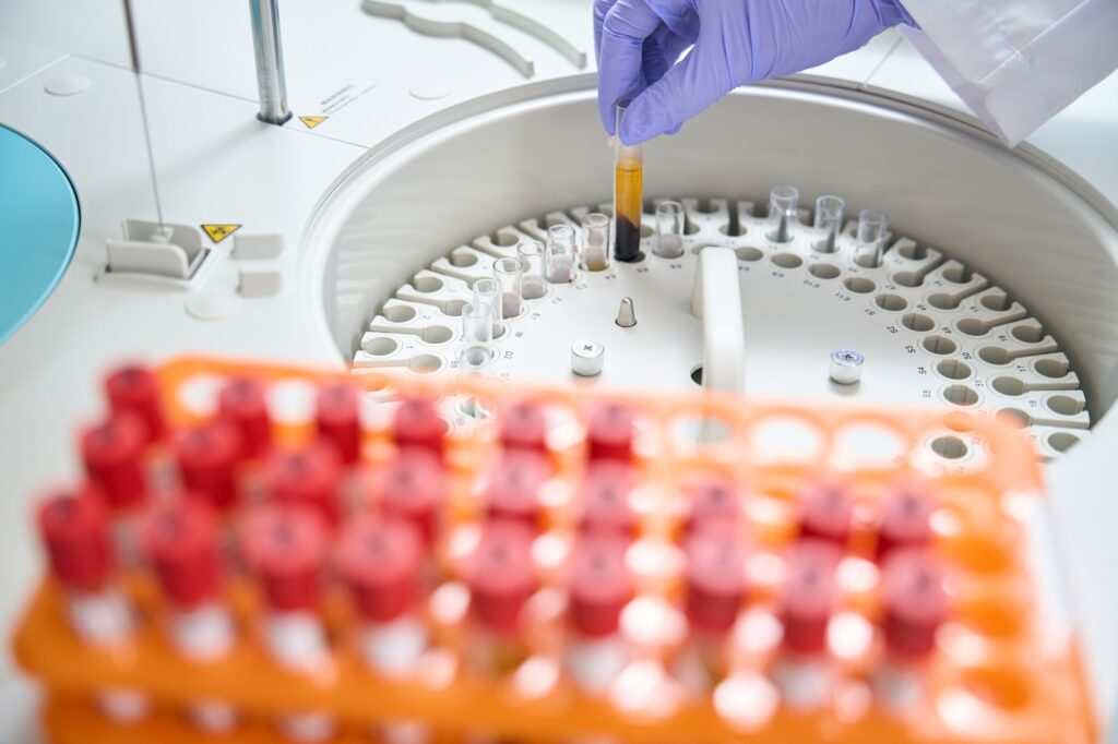 Planos que atedem no laboratório CDB Medicina Diagnóstica