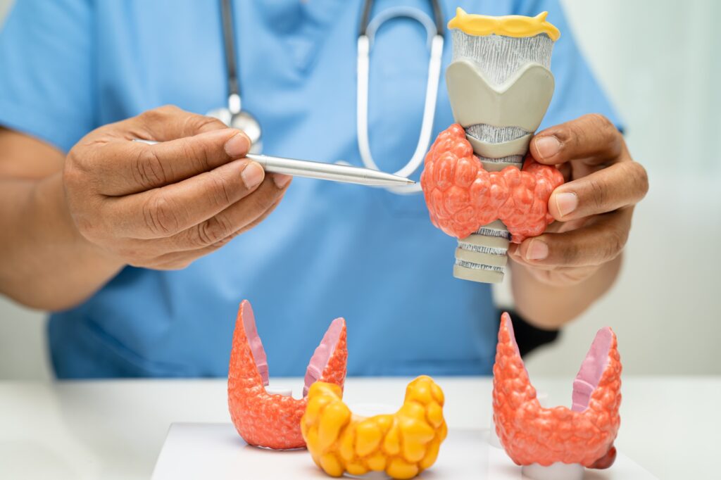 Hyperthyroidism, Overactive Thyroid, Thyroid Lymphoma, Asian doctor with thyroid gland human