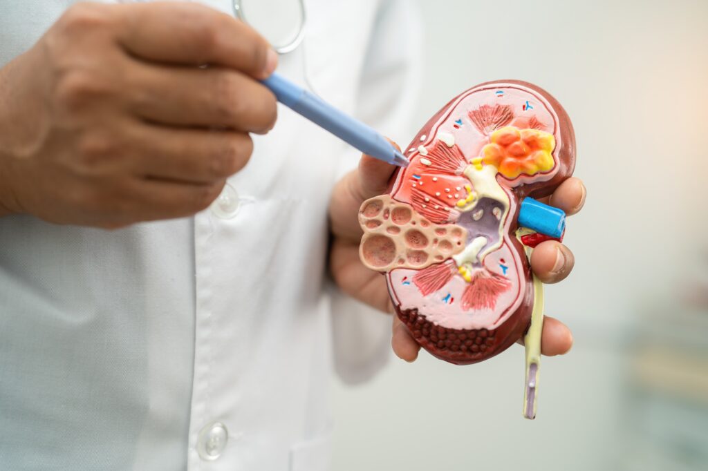 Kidney disease, Chronic kidney disease ckd, Doctor hold model to study and treat in hospital.