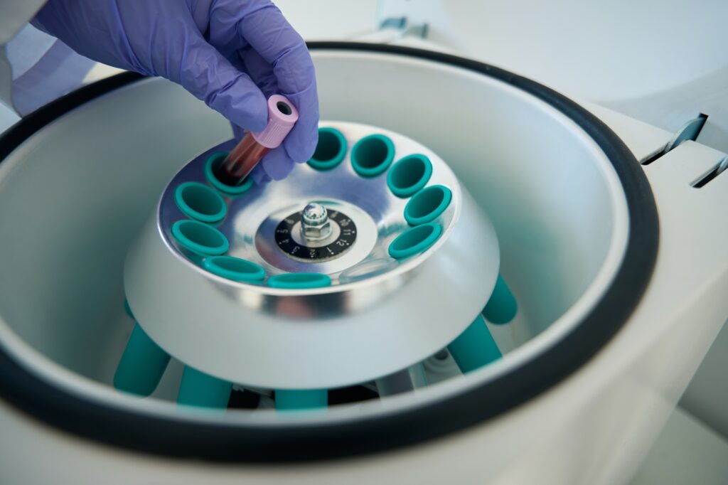 Oque é um Hematologista?