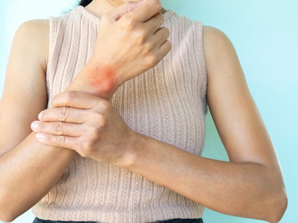 Wrist pain, woman injury hannd